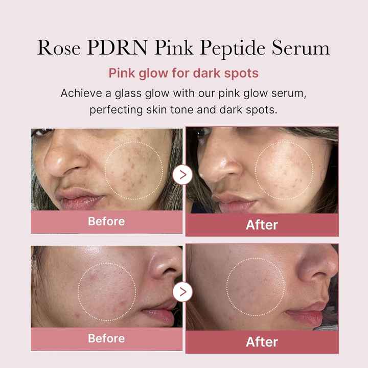 Medicube PDRN Revival Serum